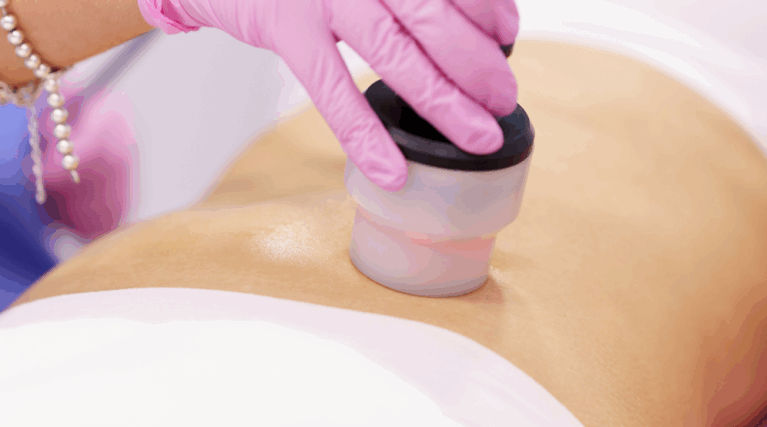 Slim Fit (Cavitation)