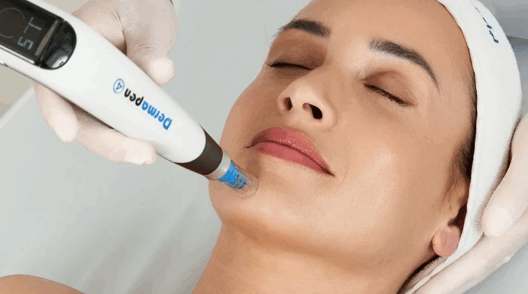 Dermapen 4